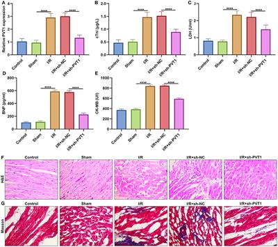 LncRNA PVT1 Knockdown Ameliorates Myocardial Ischemia Reperfusion Damage via Suppressing Gasdermin D-Mediated Pyroptosis in Cardiomyocytes